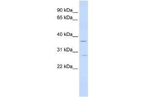 WB Suggested Anti-IFNGR2 Antibody Titration:  0. (IFNGR2 抗体  (Middle Region))