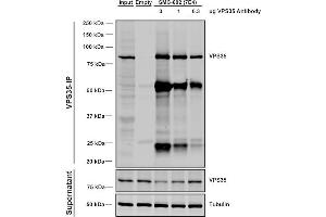 Immunoprecipitation analysis using Mouse Anti-VPS35 Monoclonal Antibody, Clone 7E4 (ABIN6932930). (VPS35 抗体  (PE))