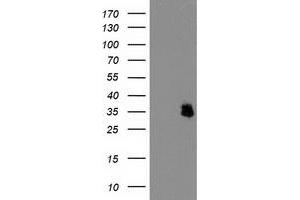 HEK293T cells were transfected with the pCMV6-ENTRY control (Left lane) or pCMV6-ENTRY IFI35 (Right lane) cDNA for 48 hrs and lysed. (IFI35 抗体)