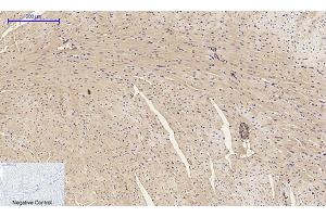 Immunohistochemical analysis of paraffin-embedded mouse heart tissue. (alpha-SMA (AA 171-220) 抗体)