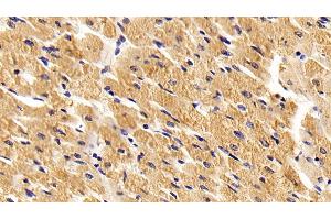 Detection of TLR2 in Porcine Cardiac Muscle Tissue using Polyclonal Antibody to Toll Like Receptor 2 (TLR2) (TLR2 抗体  (AA 47-245))
