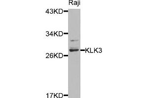 Western blot analysis of extracts of raji cells, using KLK3 antibody. (Prostate Specific Antigen 抗体)