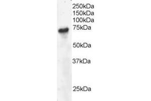 Western Blotting (WB) image for anti-B-Cell Linker (BLNK) (C-Term) antibody (ABIN2465185) (B-Cell Linker 抗体  (C-Term))