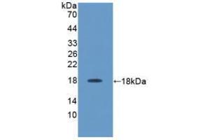 Western blot analysis of recombinant Rat IL17. (IL-17 抗体  (AA 18-150))