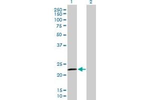 Western Blot analysis of RASGEF1B expression in transfected 293T cell line by RASGEF1B MaxPab polyclonal antibody. (RASGEF1B 抗体  (AA 1-210))