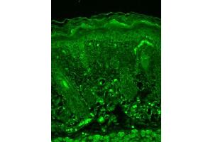 Immunohistochemistry analysis using Mouse Anti-Rhodopsin Monoclonal Antibody, Clone 1D4 . (Rhodopsin 抗体  (FITC))