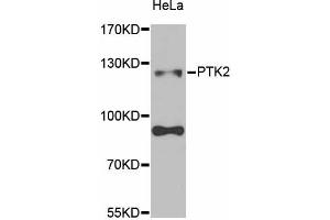 Western blot analysis of extracts of HeLa cells, using PTK2 antibody (ABIN5971141) at 1/1000 dilution. (FAK 抗体)