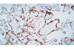 Human placenta: immunohistochemical staining for Vascular Endothelial Growth Factor Receptor-3: clone KLT9 (FLT4 抗体)