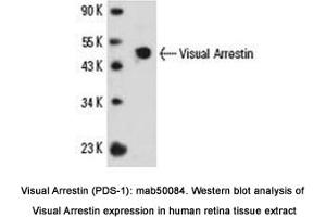 Image no. 1 for anti-S-Antigen, Retina and Pineal Gland (Arrestin) (SAG) antibody (ABIN363238) (SAG 抗体)