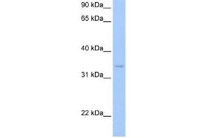 PDXK antibody used at 1 ug/ml to detect target protein. (PDXK 抗体)