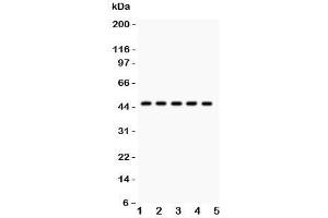 Western blot testing of PIM-1 antibody and human samples 1:  U20S;  2: A549;  3: COLO320;  4: SW620;  5: Jurkat. (PIM1 抗体  (C-Term))