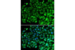 Immunofluorescence analysis of A549 cells using SH3GLB1 antibody. (SH3GLB1 抗体)
