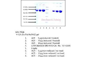 Gel Scan of Angiotensinogen, Human Plasma  This information is representative of the product ART prepares, but is not lot specific. (AGT 蛋白)