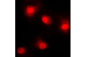 Immunofluorescent analysis of p53 staining in HeLa cells. (p53 抗体  (N-Term))