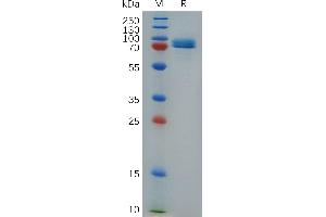 Human S Protein, hFc Tag on SDS-PAGE under reducing condition. (Stabilin 1 Protein (STAB1) (AA 638-1024) (Fc Tag))