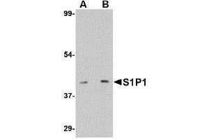 Image no. 1 for anti-Sphingosine-1-Phosphate Receptor 1 (S1PR1) (C-Term) antibody (ABIN342723) (S1PR1 抗体  (C-Term))