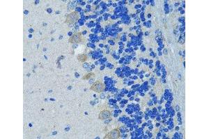 Immunohistochemistry of paraffin-embedded Mouse brain using Nestin Polyclonal Antibody at dilution of 1:100 (40x lens). (Nestin 抗体)