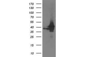 Western Blotting (WB) image for anti-ATG3 Autophagy Related 3 (ATG3) antibody (ABIN1496763) (ATG3 抗体)