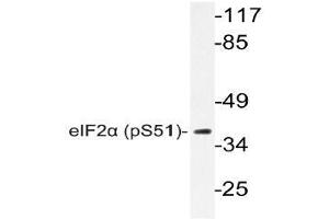 Western blot (WB) analyzes of p-eIF2alpha antibody in extracts from Jurkat insulin cells. (EIF2S1 抗体  (pSer51))