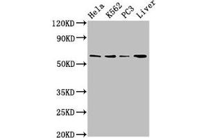 Western Blot Positive WB detected in: Hela whole cell lysate, K562 whole cell lysate, PC-3 whole cell lysate, Mouse liver tissue All lanes: RORA antibody at 2. (RORA 抗体  (AA 110-214))