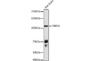Western blot analysis of extracts of Rat brain, using TRPC6 antibody (ABIN6133946, ABIN6149580, ABIN6149581 and ABIN6224178) at 1:1000 dilution. (TRPC6 抗体  (AA 500-600))