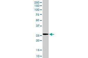 TIMP2 MaxPab rabbit polyclonal antibody. (TIMP2 抗体  (AA 1-220))