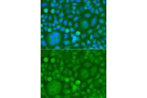Immunofluorescence analysis of HeLa cells using EPM2A antibody. (EPM2A 抗体)
