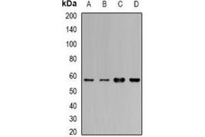 Western blot analysis of Cytochrome P450 1A1 expression in MCF7 (A), BT474 (B), mouse lung (C), mouse liver (D) whole cell lysates. (CYP1A1 抗体)