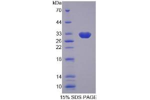 SDS-PAGE analysis of Human GBP2 Protein. (GBP2 蛋白)