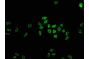 Immunofluorescence (IF) image for anti-Heterogeneous Nuclear Ribonucleoprotein C (C1/C2) (HNRNPC) antibody (ABIN7127547)