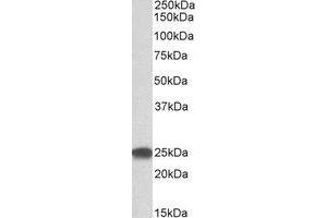 Western Blotting (WB) image for anti-Proteasome (Prosome, Macropain) Subunit, beta Type, 4 (PSMB4) (Internal Region) antibody (ABIN2464902) (PSMB4 抗体  (Internal Region))