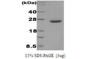 Figure annotation denotes ug of protein loaded and % gel used. (DsbC 蛋白)