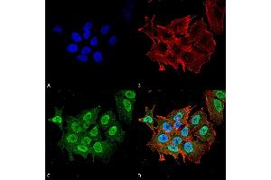 Immunocytochemistry/Immunofluorescence analysis using Mouse Anti-Ataxin 1 Monoclonal Antibody, Clone S76-8 . (Ataxin 1 抗体  (AA 164-197) (PerCP))