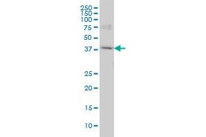 Western Blotting (WB) image for anti-Polymerase (RNA) I Polypeptide C, 30kDa (POLR1C) (AA 1-347) antibody (ABIN599084) (POLR1C 抗体  (AA 1-347))