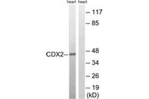 Western blot analysis of extracts from rat heart, using CDX2 (Ab-283) Antibody. (CDX2 抗体  (AA 249-298))