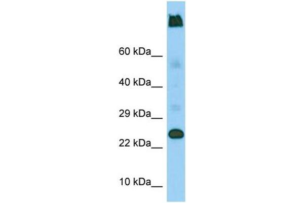 LY6G5C 抗体  (C-Term)