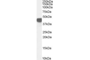 Western Blotting (WB) image for anti-Argininosuccinate Synthase 1 (ASS1) (Internal Region) antibody (ABIN2466477) (ASS1 抗体  (Internal Region))