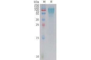 Cynomolgus GC Protein, His Tag on SDS-PAGE under reducing condition. (GUCY2C Protein (AA 24-430) (His tag))