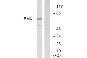 Western Blotting (WB) image for anti-BMX Non-Receptor Tyrosine Kinase (BMX) (N-Term) antibody (ABIN1849423) (BMX 抗体  (N-Term))