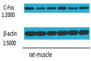 Western Blot (WB) analysis: Please contact us for more details. (c-FOS 抗体)