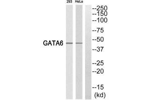 Western Blotting (WB) image for anti-GATA Binding Protein 6 (GATA6) (C-Term) antibody (ABIN1852618) (GATA6 抗体  (C-Term))