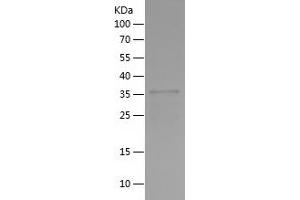 Western Blotting (WB) image for Nuclear Receptor Subfamily 2, Group E, Member 3 (NR2E3) (AA 113-245) protein (His-IF2DI Tag) (ABIN7124213) (NR2E3 Protein (AA 113-245) (His-IF2DI Tag))