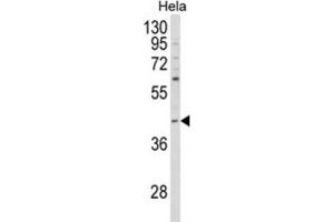 Western Blotting (WB) image for anti-NCK Adaptor Protein 1 (NCK1) antibody (ABIN3003930) (NCK1 抗体)