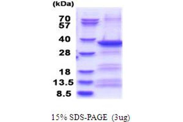 EXOSC3 Protein (AA 1-275) (His tag)