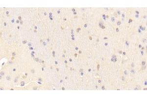 Immunohistochemistry (IHC) image for anti-Reelin (RELN) (AA 3143-3461) antibody (ABIN7435136)