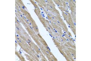 Immunohistochemistry of paraffin-embedded rat heart using DFNA5 antibody (ABIN5975144) at dilution of 1/100 (40x lens). (DFNA5 抗体)
