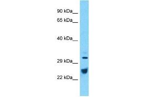 Host:  Rabbit  Target Name:  ATP1B1  Sample Type:  Thymus Tumor lysates  Antibody Dilution:  1. (ATP1B1 抗体  (C-Term))