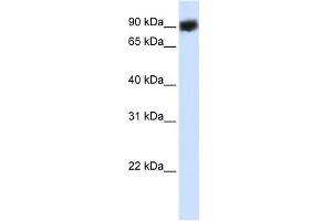 WB Suggested Anti-HSP90B1 Antibody Titration:  0. (GRP94 抗体  (C-Term))