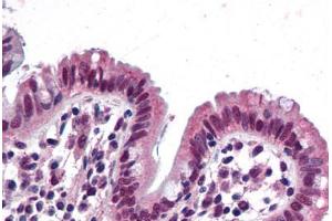 Human Colon: Formalin-Fixed, Paraffin-Embedded (FFPE) (SMARCB1 抗体  (AA 81-181))