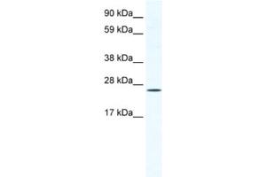 Western Blotting (WB) image for anti-BRF1, RNA polymerase III transcription initiation factor subunit (BRF1) antibody (ABIN2461519) (BRF1 抗体)